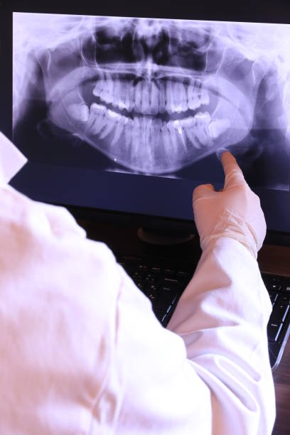 Best Same-Day Emergency Dental Services in West Ishpeng, MI