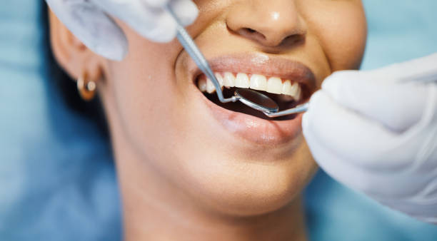 Best Emergency Treatment for Dental Infections or Abscesses in West Ishpeng, MI