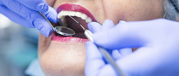 Best Emergency Root Canal Treatment in West Ishpeng, MI